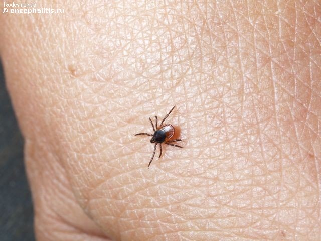 Врачи области дали рекомендации по майским праздникам