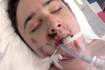 Принцу Монако в одном из клубов Нью-Йорка разбили лицо